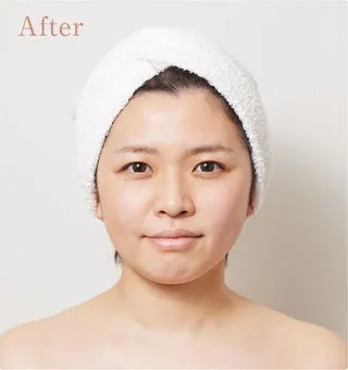 マイクロカレント美容法